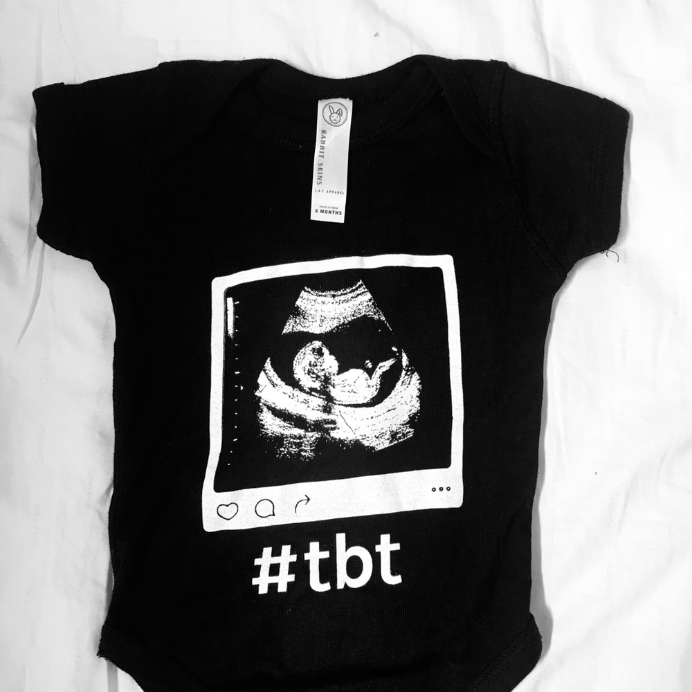 “Rabbit Skins” baby onesie